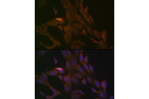 Immunofluorescence analysis of NIH-3T3 cells using PER3 Rabbit mAb (ABIN7269225) at dilution of 1:100 (40x lens). (PER3 anticorps)