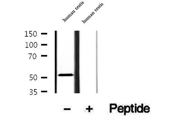 AEBP2 anticorps  (Internal Region)