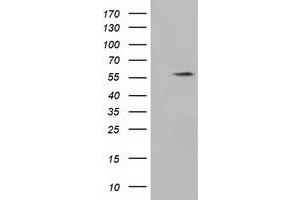 HEK293T cells were transfected with the pCMV6-ENTRY control (Left lane) or pCMV6-ENTRY KLHL2 (Right lane) cDNA for 48 hrs and lysed. (KLHL2 anticorps  (AA 1-100, AA 494-593))