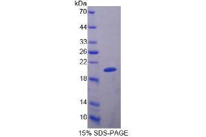 SDS-PAGE analysis of Human MRPL1 Protein. (MRPL1 Protéine)