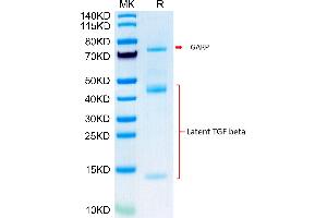 Biotinylated Mouse GARP&Latent TGF beta Complex on Tris-Bis PAGE under reduced condition. (GARP & Latent TGF beta 1 Complex (AA 18-628) protein (His-Avi Tag,Biotin))