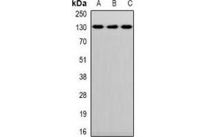 Western blot analysis of CD144 expression in Hela (A), mouse lung (B), mouse heart (C) whole cell lysates. (Cadherin 5 anticorps)