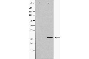 Western blot analysis of extracts of HUVEC, using HSP27 antibody. (HSP27 anticorps  (N-Term))