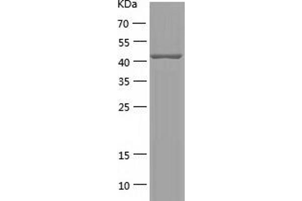 Paralemmin Protein (PALM) (AA 1-387) (His tag)