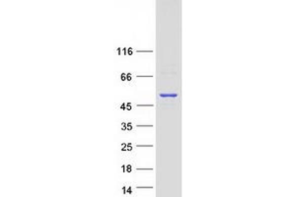 IPMK Protein (Myc-DYKDDDDK Tag)