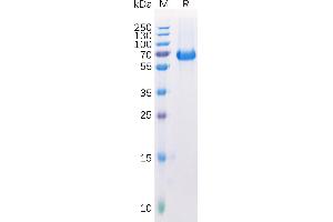 Human E Protein, His Tag on SDS-PAGE under reducing condition. (EPH Receptor A2 Protein (EPHA2) (AA 24-534) (His tag))