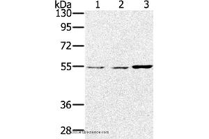 Western blot analysis of Lovo, hela and SKOV3 cell, using SESN2 Polyclonal Antibody at dilution of 1:300 (Sestrin 2 anticorps)