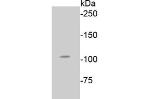 Lane 1: A549 lysates probed with Rb(S807) (2D10) Monoclonal Antibody  at 1:1000 overnight at 4˚C. (Retinoblastoma 1 anticorps  (pSer807))