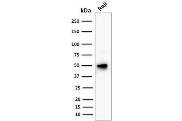 CD79a anticorps  (AA 202-216)