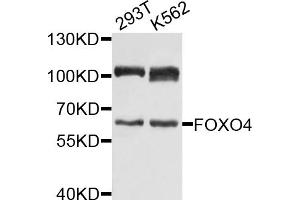Western blot analysis of extracts of various cell lines, using FOXO4 antibody (ABIN1872735) at 1:1000 dilution. (FOXO4 anticorps)
