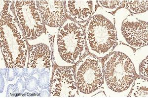 Immunohistochemical analysis of paraffin-embedded rat testis tissue. (NF-kB p65 anticorps  (acLys310))