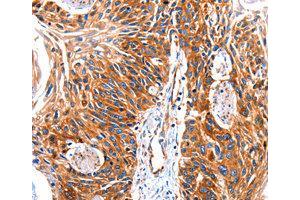 Immunohistochemistry (IHC) image for anti-G Protein-Coupled Receptor Kinase 1 (GRK1) antibody (ABIN1872898) (GRK1 anticorps)