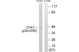 Western blot analysis of extracts from HUVEC cells, treated with UV (15 mins), using Chk1 (Phospho-Ser296) antibody. (CHEK1 anticorps  (pSer296))