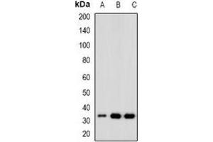 Western blot analysis of CDK6 expression in Hela (A), Jurkat (B), K562 (C) whole cell lysates. (CDK6 anticorps)