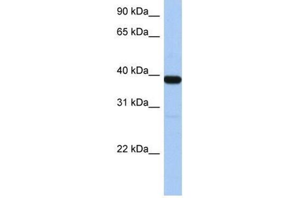 ZNF781 anticorps  (N-Term)