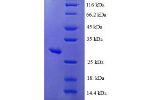 SDS-PAGE (SDS) image for Methionine Sulfoxide Reductase A (MSRA) (AA 24-235) protein (His tag) (ABIN5711905) (MSRA Protein (AA 24-235) (His tag))