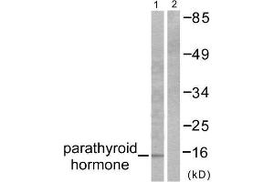 Western Blotting (WB) image for anti-Parathyroid Hormone (PTH) (Internal Region) antibody (ABIN1848724) (PTH anticorps  (Internal Region))