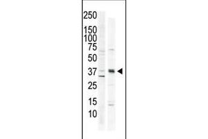 The anti-CK1 C-term Pab (ABIN391310 and ABIN2841344) is used in Western blot to detect CK1 in HeLa cell lysate (lane 1) and primate brain tissue lysate (lane 2). (CAMK1 anticorps  (C-Term))