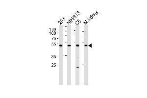 Western blot analysis of lysates from 293, mouse NIH/3T3, rat C6 cell line and mouse kidney tissue lysate(from left to right), using Mouse Cdk9 Antibody at 1:1000 at each lane. (CDK9 anticorps  (C-Term))