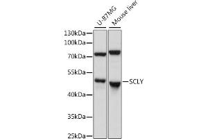 Western blot analysis of extracts of various cell lines, using SCLY antibody (ABIN7270191) at 1:1000 dilution. (SCLY anticorps  (AA 284-453))