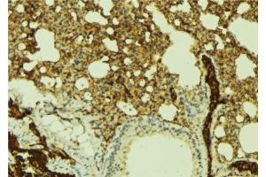 ABIN6269383 at 1/100 staining Mouse lung tissue by IHC-P. (ATRIP anticorps  (N-Term))