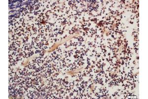 Formalin-fixed and paraffin embedded mouse spleen labeled with Rabbit Anti-FAK (Tyr925) Polyclonal Antibody, Unconjugated  at 1:200 followed by conjugation to the secondary antibody and DAB staining (FAK anticorps  (pTyr925))