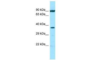 Host: Rabbit  Target Name: NFKBIA  Sample Tissue: Hela Whole Cell lysates  Antibody Dilution: 1. (NFKBIA anticorps  (N-Term))