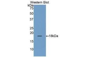 Detection of Recombinant RBP2, Human using Polyclonal Antibody to Retinol Binding Protein 2, Cellular (RBP2) (RBP2 anticorps  (AA 1-134))