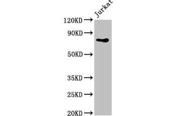 PIK3R2 anticorps  (Regulatory Subunit beta)