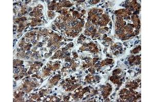 Immunohistochemical staining of paraffin-embedded pancreas tissue using anti-LIPG mouse monoclonal antibody. (LIPG anticorps)