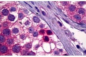 Anti-PDK1 antibody IHC staining of human testis, spermatogonia. (PDPK1 anticorps)