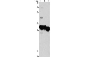 Western Blotting (WB) image for anti-Ketohexokinase (KHK) antibody (ABIN2422887) (Ketohexokinase anticorps)