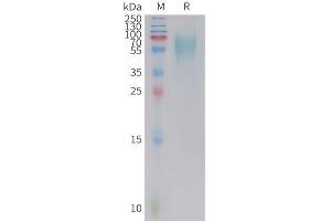 Cynomolgus 5T4 Protein, His Tag on SDS-PAGE under reducing condition. (TPBG Protein (AA 35-355) (His tag))