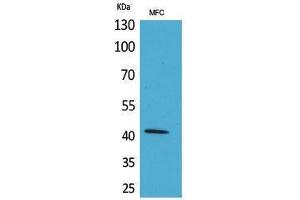 Western Blotting (WB) image for anti-alpha-SMA (C-Term) antibody (ABIN3180983) (alpha-SMA (C-Term) anticorps)