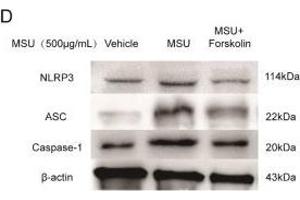 Western Blotting (WB) image for anti-NLR Family, Pyrin Domain Containing 3 (NLRP3) (AA 15-120) antibody (ABIN1386361)