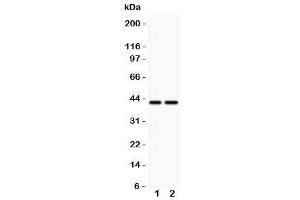 Western blot testing of CD244 antbody and  Lane 1: MCF-7 (2B4 anticorps  (C-Term))