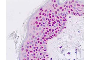 Anti-PAX7 antibody IHC staining of human skin, epidermis. (PAX7 anticorps  (AA 410-437))