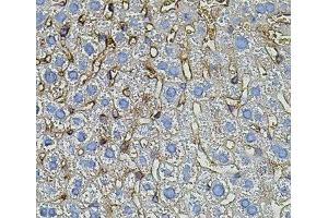 Immunohistochemistry of paraffin-embedded Mouse liver using TGFA Polyclonal Antibody (TGFA anticorps)