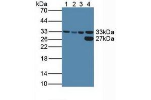 Figure. (CDK2 anticorps  (AA 94-198))