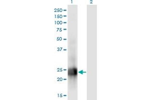m1ip1 anticorps  (AA 1-183)