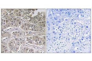 Immunohistochemistry (IHC) image for anti-Solute Carrier Family 25 (Mitochondrial Oxodicarboxylate Carrier), Member 21 (Slc25a21) (Internal Region) antibody (ABIN1851571) (SLC25A21 anticorps  (Internal Region))