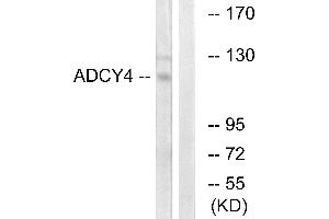 Western blot analysis of extracts from Jurkat cells, using ADCY4 antibody. (ADCY4 anticorps)