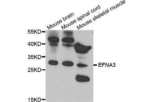 Western Blotting (WB) image for anti-Ephrin A3 (EFNA3) (AA 23-214) antibody (ABIN6219775) (Ephrin A3 anticorps  (AA 23-214))