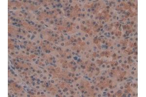 IHC-P analysis of Rat Stomach Tissue, with DAB staining. (OTUB1 anticorps  (AA 1-271))