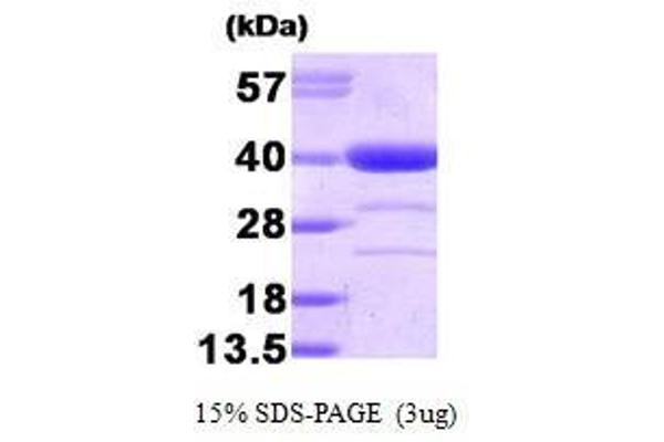 Alcohol Dehydrogenase (ADH) (AA 1-325) Protéine