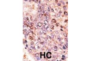 Immunohistochemistry (IHC) image for anti-ATP-Binding Cassette, Sub-Family B (MDR/TAP), Member 7 (ABCB7) antibody (ABIN3002511) (ABCB7 anticorps)