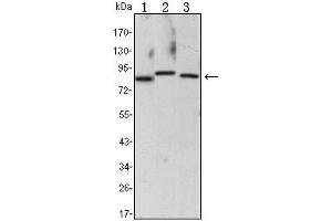 Western Blot showing CHUK antibody used against Raji (1), Jurkat (2) and THP-1 (3) cell lysate. (IKK alpha anticorps)
