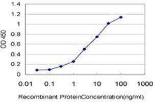 Detection limit for recombinant GST tagged SRPK1 is approximately 0. (SRPK1 anticorps  (AA 371-470))