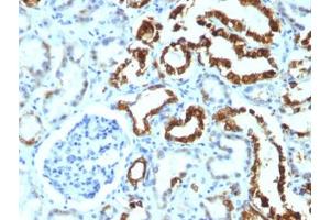 Immunohistochemistry (Formalin-fixed Paraffin-embedded Sections) (IHC (fp)) image for anti-Milk Fat Globule-EGF Factor 8 Protein (MFGE8) antibody (ABIN3025866)