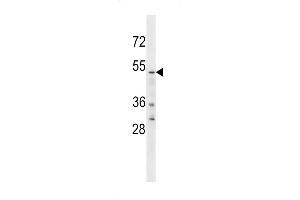 Western blot analysis in U251 cell line lysates (35ug/lane). (YTHDF2 anticorps  (C-Term))